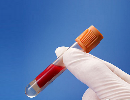 高血脂，隱秘的溫柔殺手