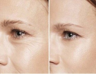 提前衰老、抵抗力差，用熟三七粉，抗衰還能補氣血！